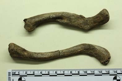 Healed clavicle fracture in Burial 20. Source: Photo by Scott Burnett 2011.